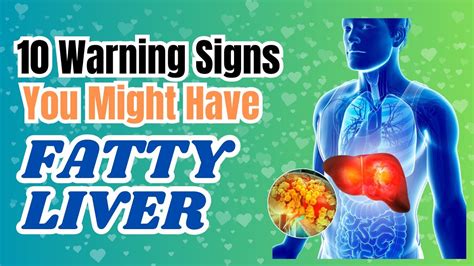 Fatty Liver 10 Warning Signs You Might Have Fatty Liver Fattyliver