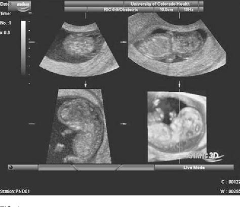 Figure From Comparison Of Conventional Transabdominal And