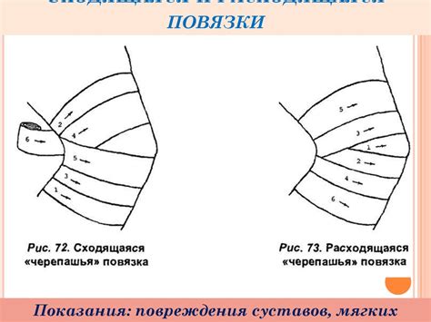 Повязки в хирургии - online presentation