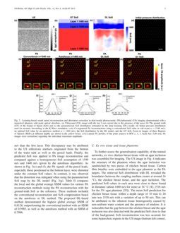 Learning Based Sound Speed Reconstruction And Aberration Correction In