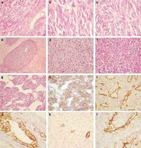 Photomicrographs Of Haematoxylin Eosin Stained Sections And