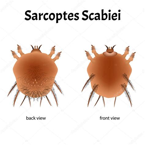 Sarcoptes Scabiei Sarna Enfermedades De Transmisi N Sexual