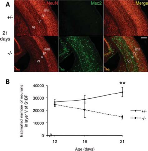 Loss Of Cortical Layer V S Bf Neurons In Ngd Mice A Double