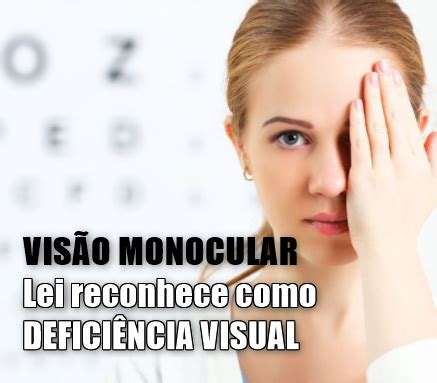 Sua Maior Defesa Sempre A Informa O Lei Reconhece Vis O Monocular