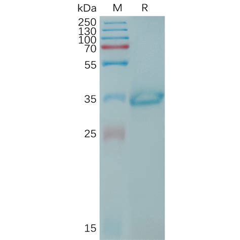 Human Cldn Protein Hfc Tag Dima Biotechnology