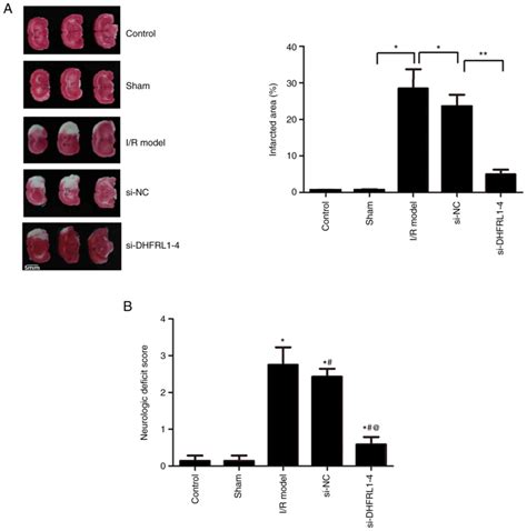 Lncrna Dhfrl Knockdown Attenuates Cerebral Ischemia Reperfusion