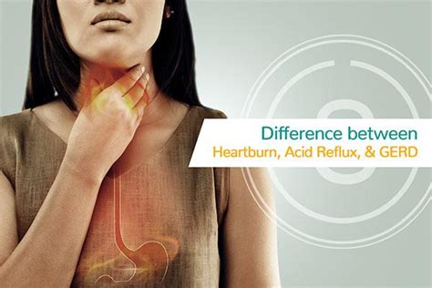 Difference Between Heartburn Acid Reflux And GERD SMILES