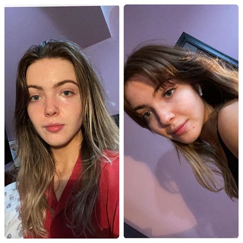 You won't believe which celebrity has a basin haircut now 6