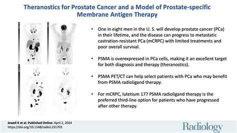 Emerging Theranostics For Prostate Cancer And A Model Of Prostate