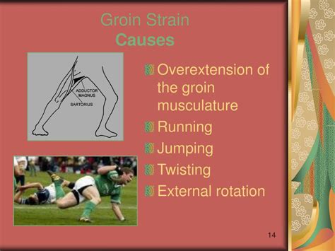 Ppt Injuries Of The Hip And Groin Powerpoint Presentation Free