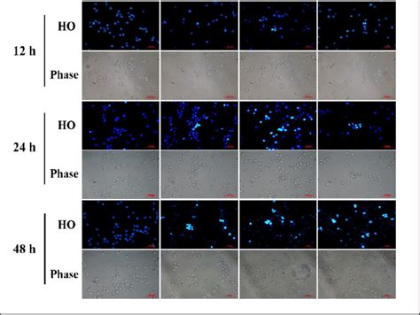 Hoechst Staining In L Cells After M Horridula Treatment