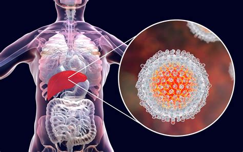 Controles Clínicos Y Pruebas Recomendadas En Los Pacientes Con Hepatitis C Que Han Tenido