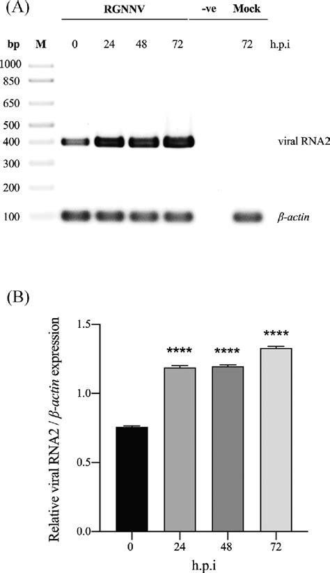 Replication Of Rgnnv In E 11 Cells E 11 Cells Were Infected With Rgnnv