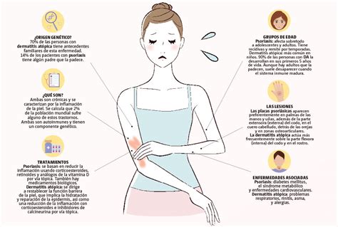 Psoriasis y dermatitis atópica enfermedades de la piel Grupo Milenio