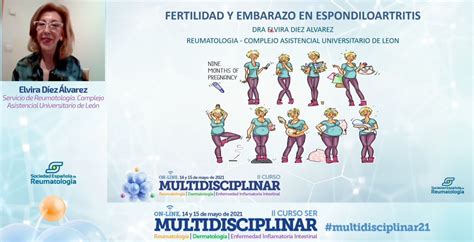 Soc Esp Reumatología on Twitter multidisciplinar21 En mujeres con