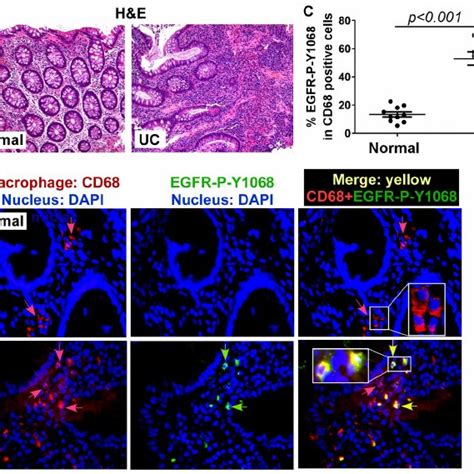 EGFR In Macrophages Regulates Cytokine Production In DSS Induced Acute