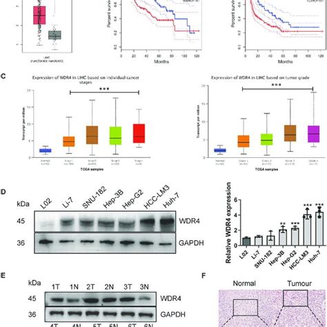 Wdr Expression Is Significantly Increased In Hcc A Analysis Of Wdr