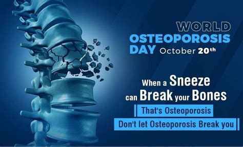 Dr Raos Is The Best Osteoporosis Treatment