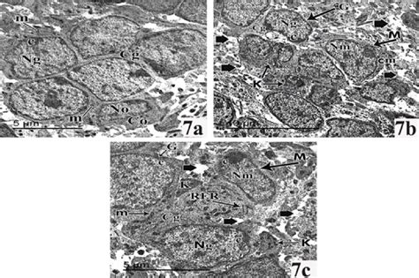 Transmission Electron Micrographs Of Cerebellar Cortex Of Pnd