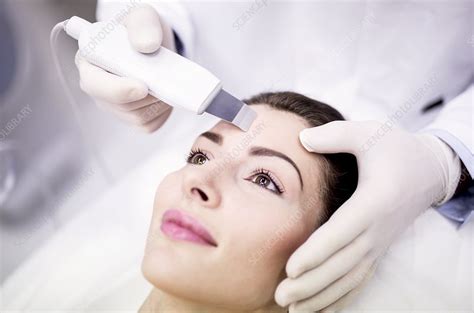 Facial microdermabrasion treatment - Stock Image - F022/9532 - Science ...