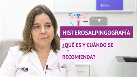 En qué consiste la histerosalpingografía Cuándo se recomienda