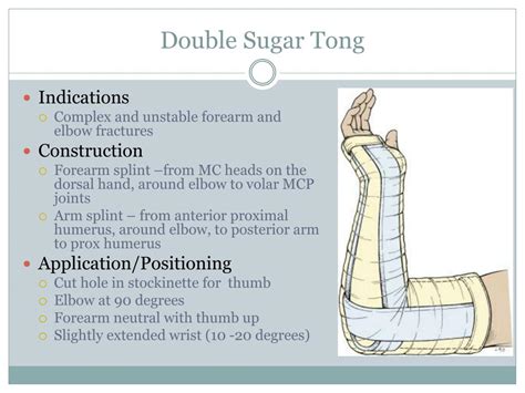 PPT - Procedures: Splinting PowerPoint Presentation, free download - ID:2280962