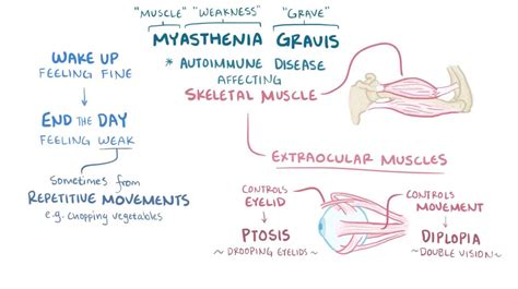 Pathophysiology Of Myasthenia Gravis Schematic Diagram Myast