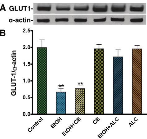 Western Blot Analysis Of Glut1 In Etoh Treated Human Astrocytes A