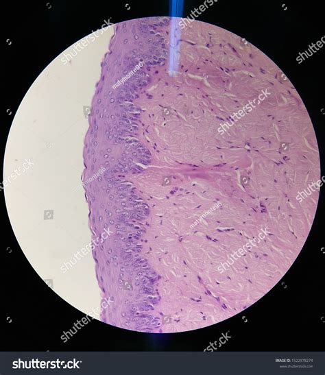 Microphotography Esophagus Mucosa Stratified Squamous Epithelium Stock ...