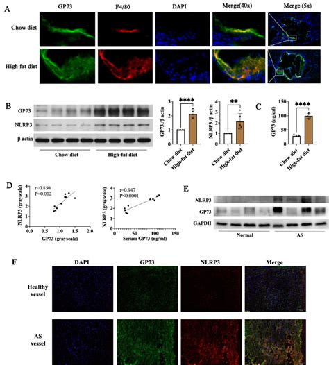Expression of GP73 in the aorta and serum level of GP73 protein were ...