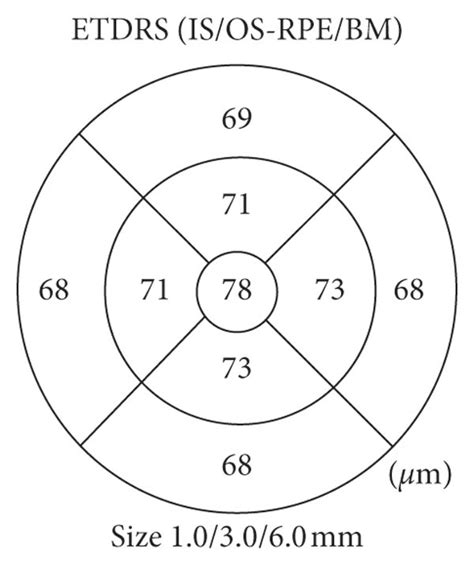 A OCT Radial Scan ETDRS Map B Retinal Pigment Epithelium And