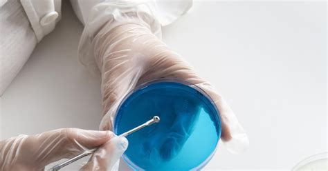 Unlocking The Secrets Of Plasmid Preparation A Step By Step Guide