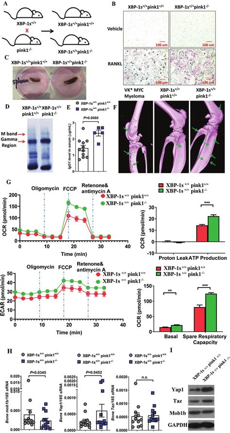 Pink1 Deletion Accelerates Myeloma Development And Progression In