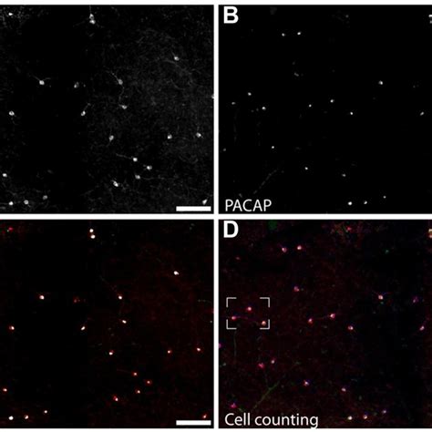 Staining For Melanopsin And Pacap Reveals That They Are Expressed In