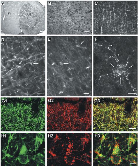 Photomicrographs Showing Patterns Of Immunolabeling Obtained With Download Scientific Diagram