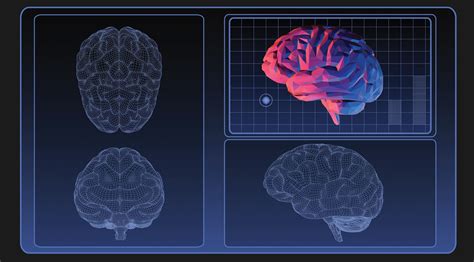 Focused Ultrasound To Treat Parkinsons Apda