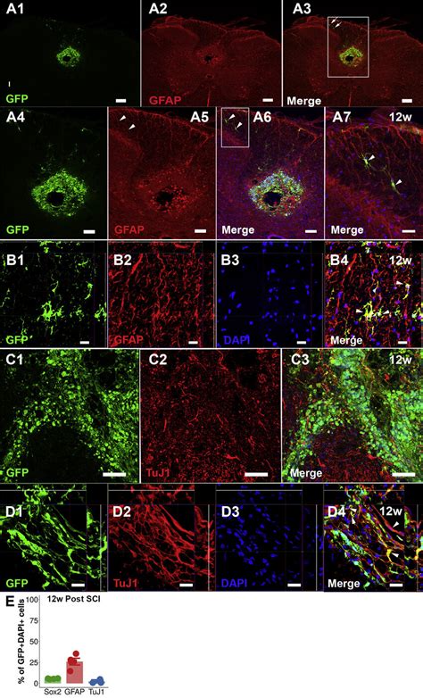 Expression Of Gfap And Tuj In Transplanted Npcs A A A