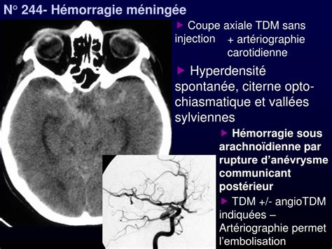 PPT Pr Ivan Bricault Clinique Universitaire De Radiologie Et Imagerie