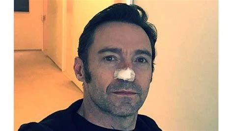 Hugh Jackman Reveals Another Skin Cancer Treatment