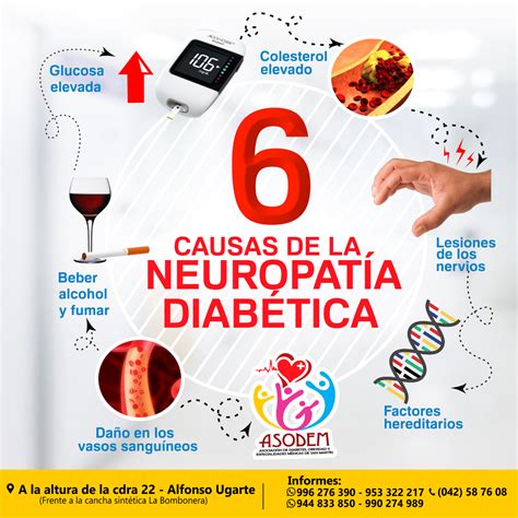 Causas De La NeuropatÍa DiabÉtica😥😥 Neuropatías Diabéticas Son Un