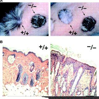 Transplantation Of The Claudin Deficient Skin To Nude Mice A