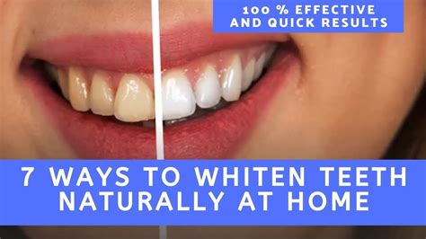 How To Whiten Teeth At Home 7 Home Remedies To Whiten Teeth Quickly