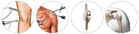 Knee Shoulder Arthroscopy And Joint Replacement Fellowship Copy Knee And Shoulder Surgeon