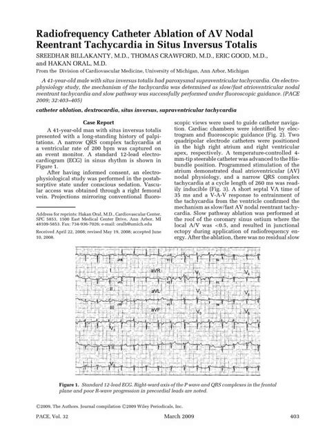 PDF Radiofrequency Catheter Ablation Of AV Nodal Reentrant