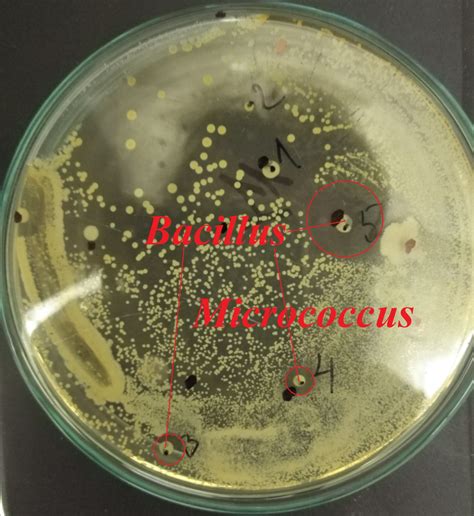 Bacillus Vs Micrococcus