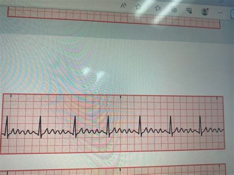 Waveforms Intervals And Segments Flashcards Quizlet