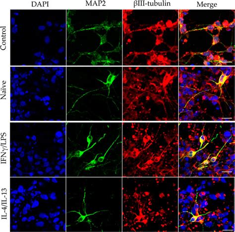 Frontiers Microglia Modulate Proliferation Neurite Generation And Differentiation Of Human