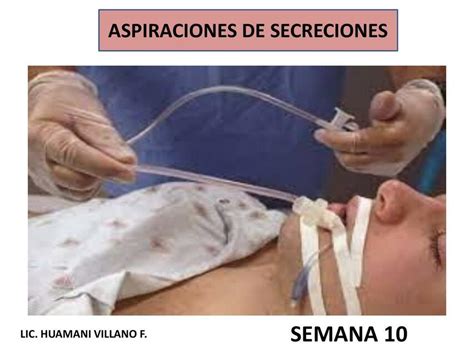 Aspiraciones De Secreciones Daye Sanchez Udocz