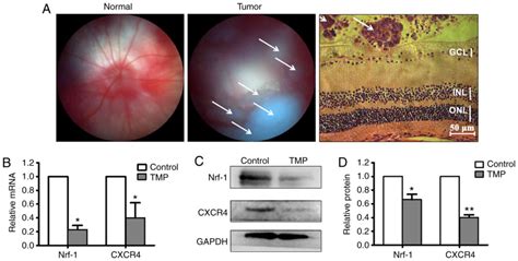 Tetramethylpyrazine Downregulates Transcription Of The CXC Receptor 4