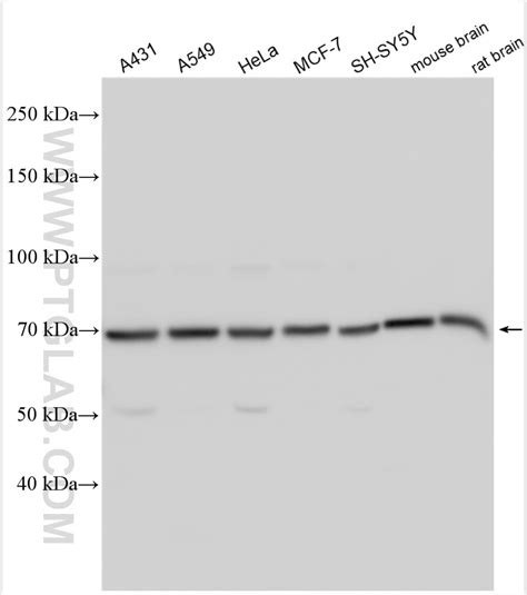 NRG1 Isoform Alpha Antibody 31043 1 AP Proteintech